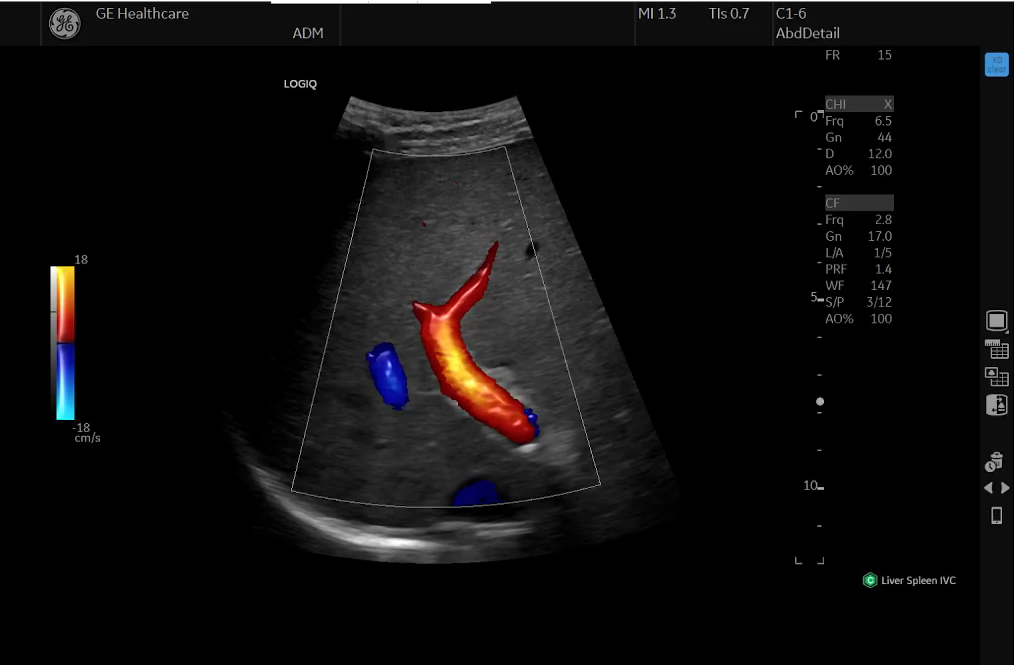 logiq totus gal image67