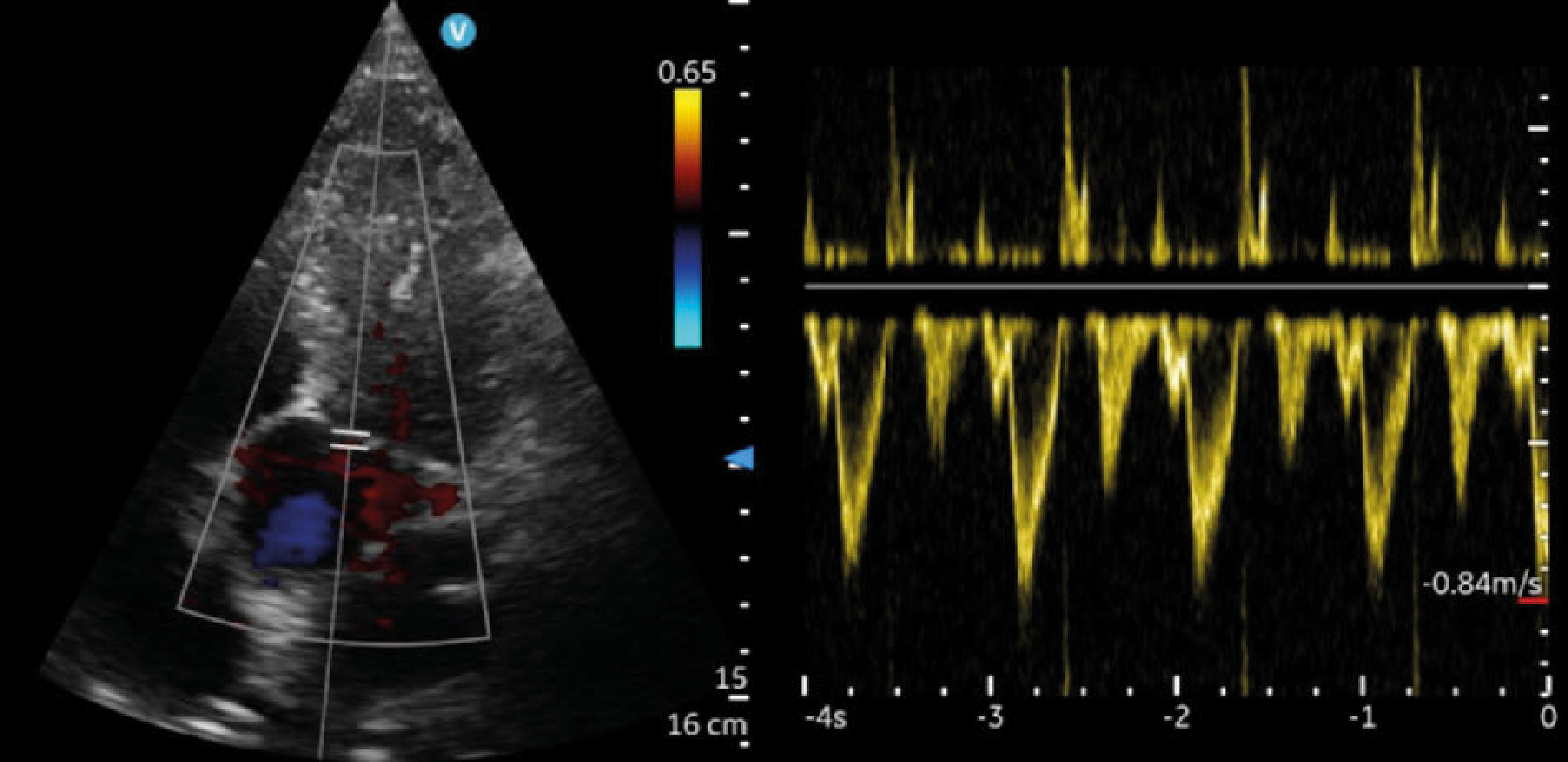 vscan air sl Recurso 3@rc