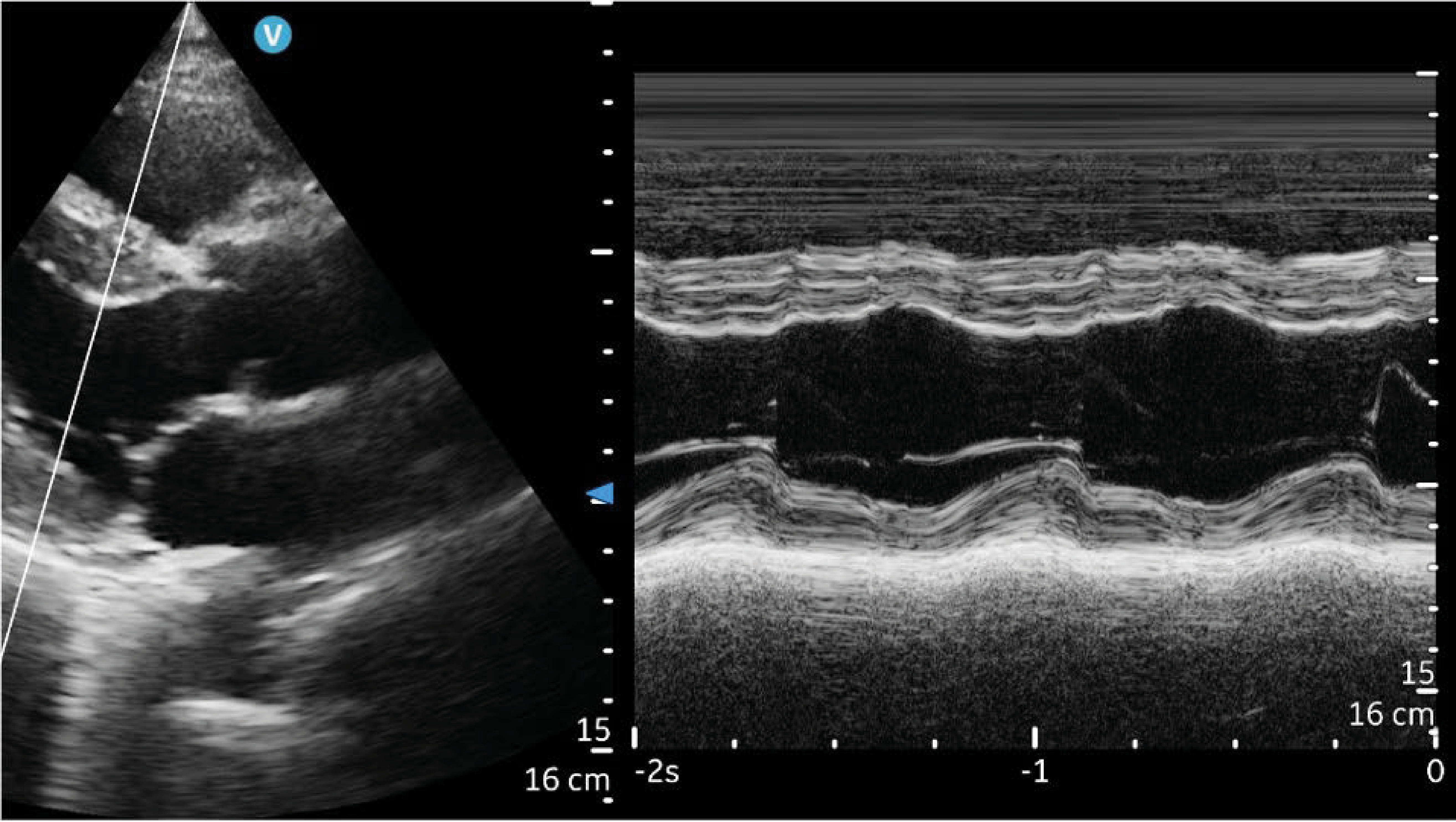 vscan air sl Recurso 4@rc