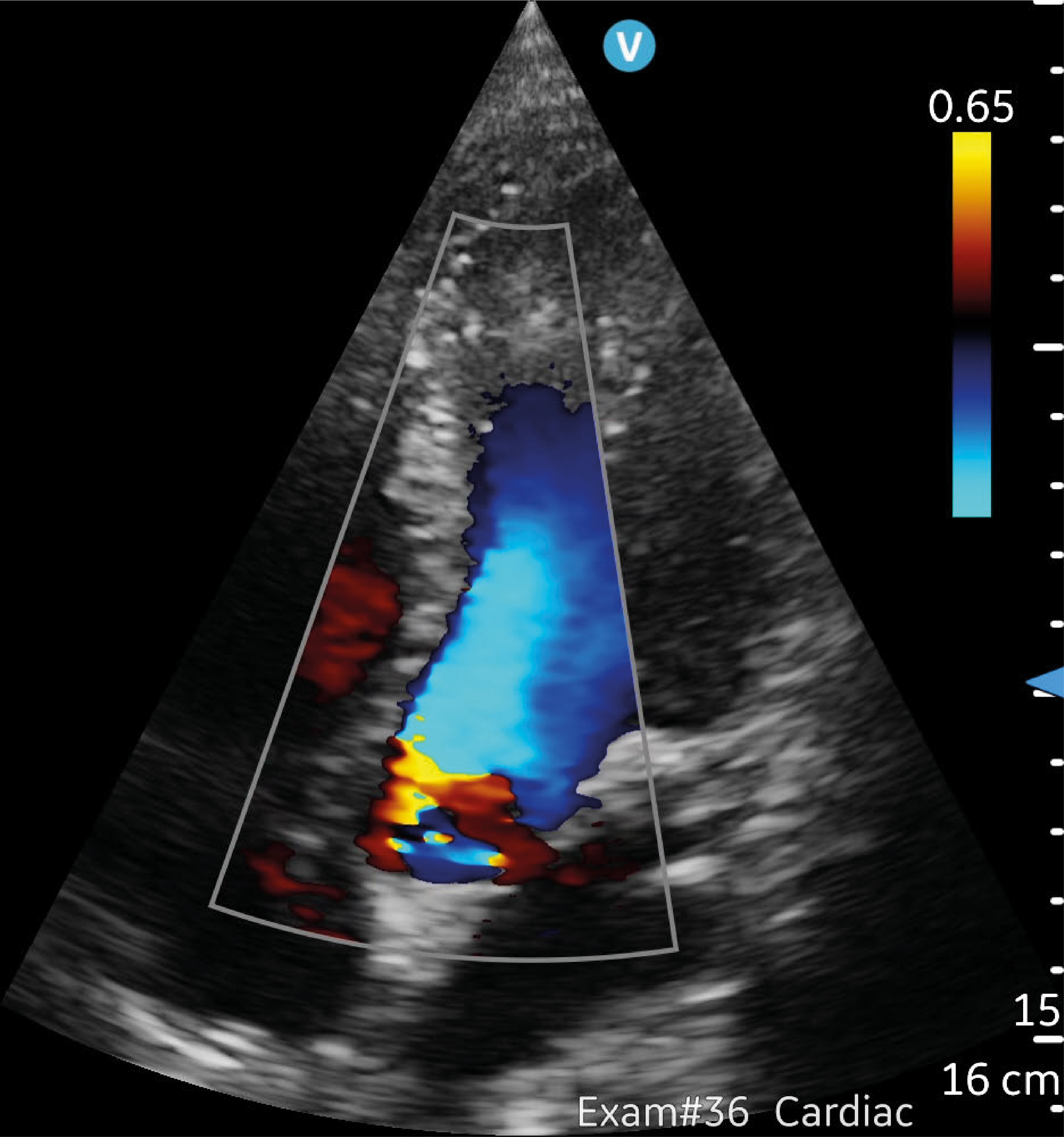 vscan air sl Recurso 5@rc