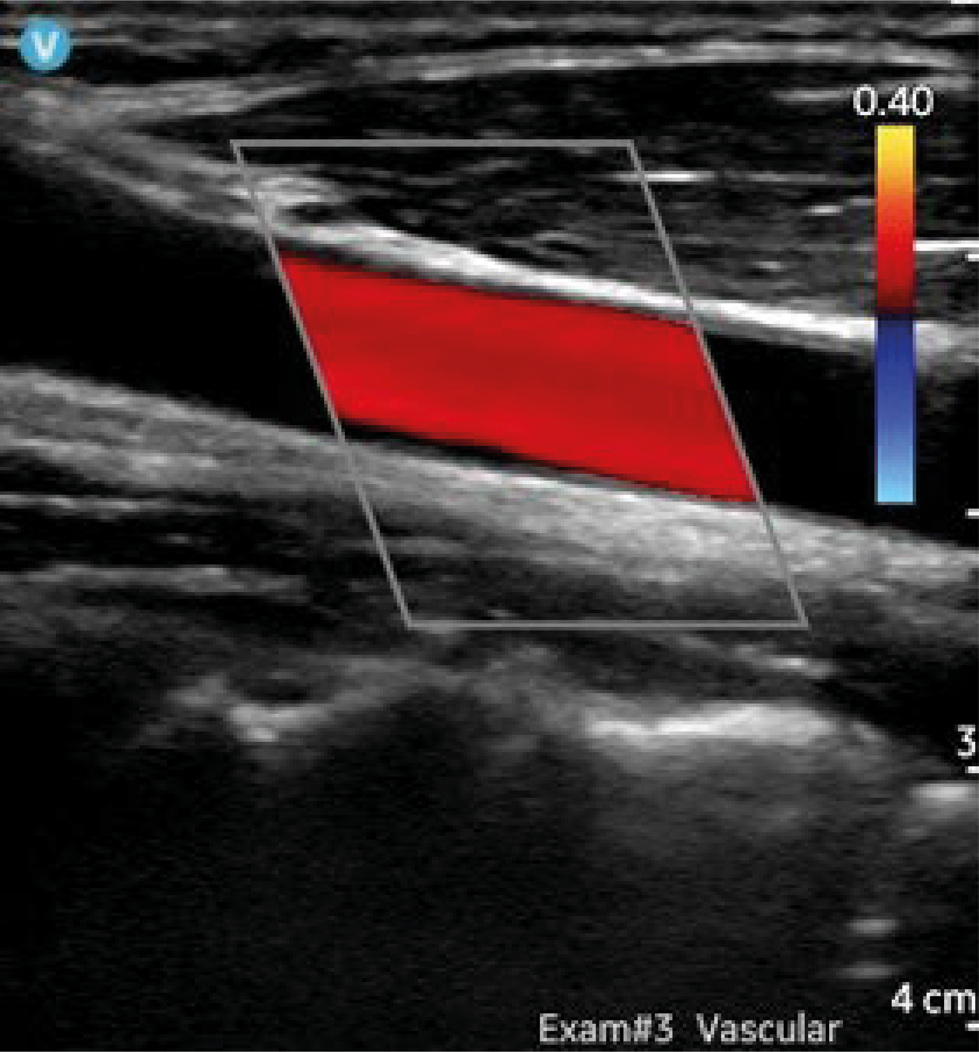 vscan air sl Recurso 7@rc