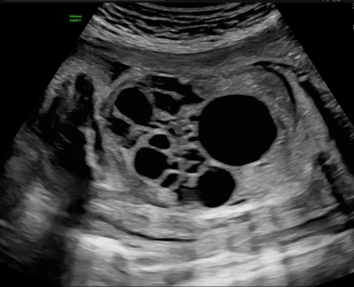 Imagen1vol swift gal 7