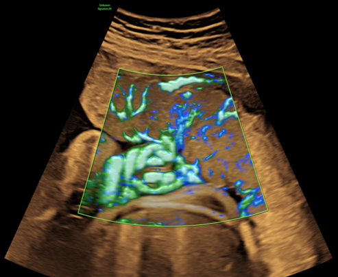 Imagen1voluson 20.gal.6