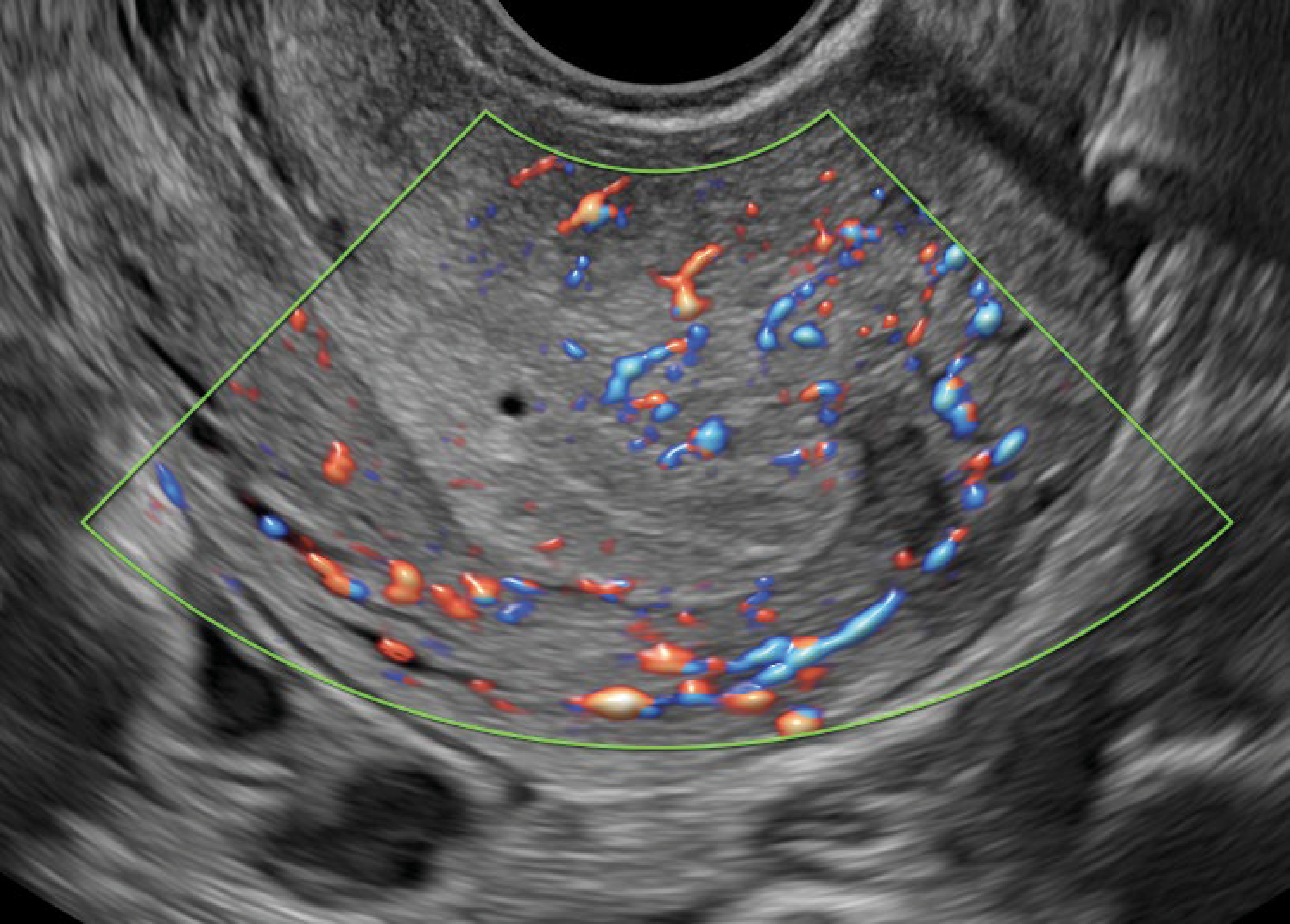 Recurso 10performance 16 18