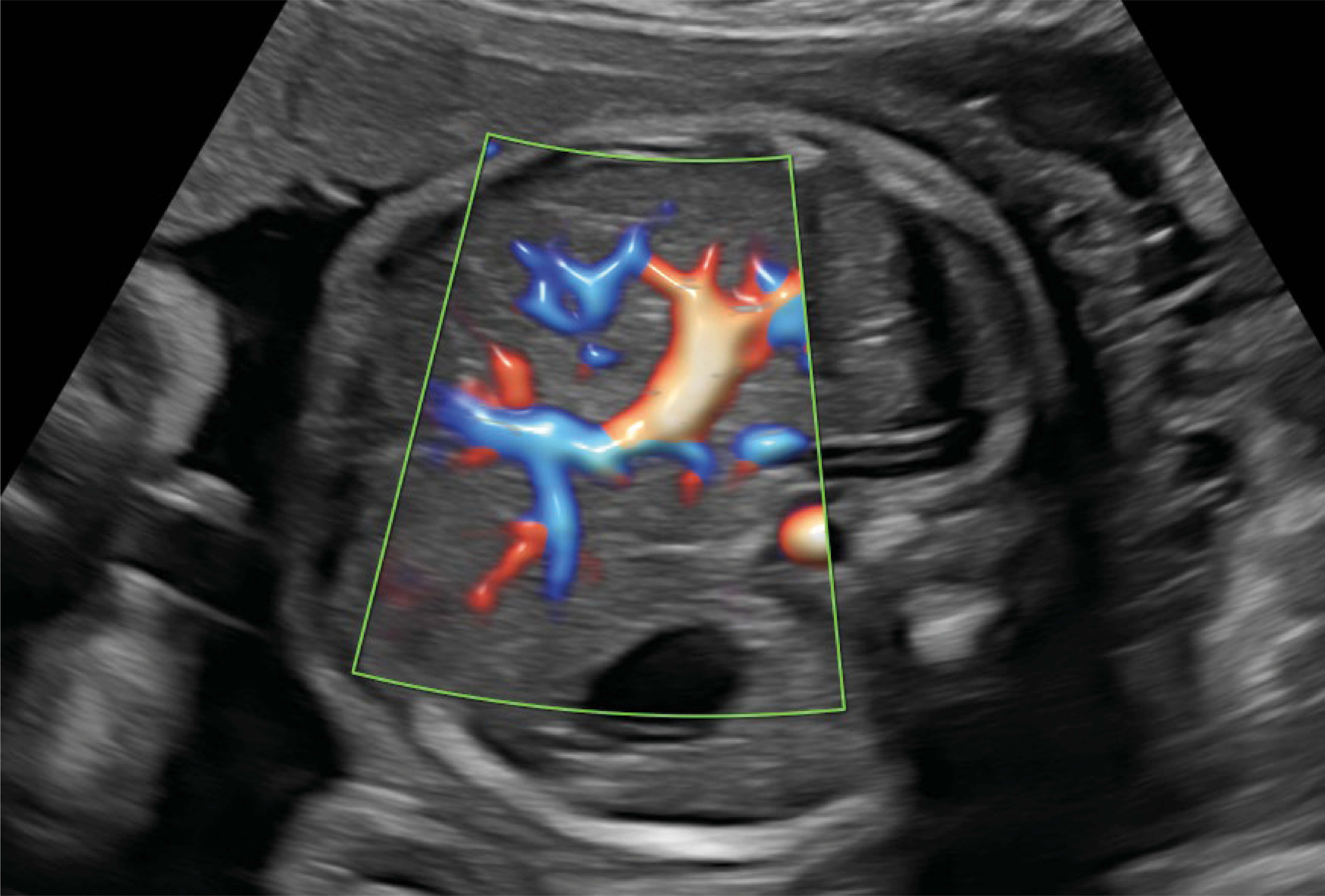 Recurso 11performance 16 18