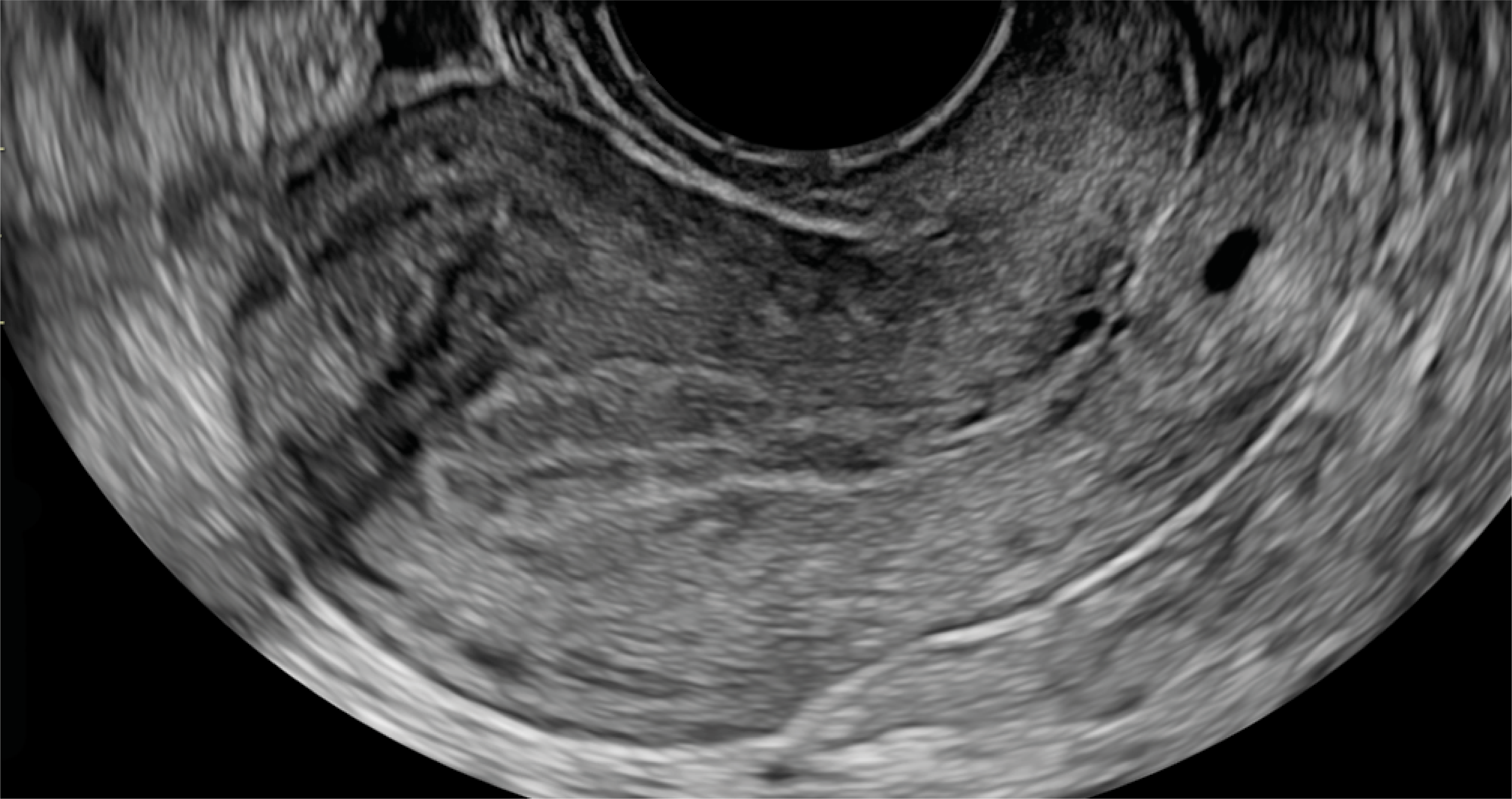 Recurso 2performance 16 18