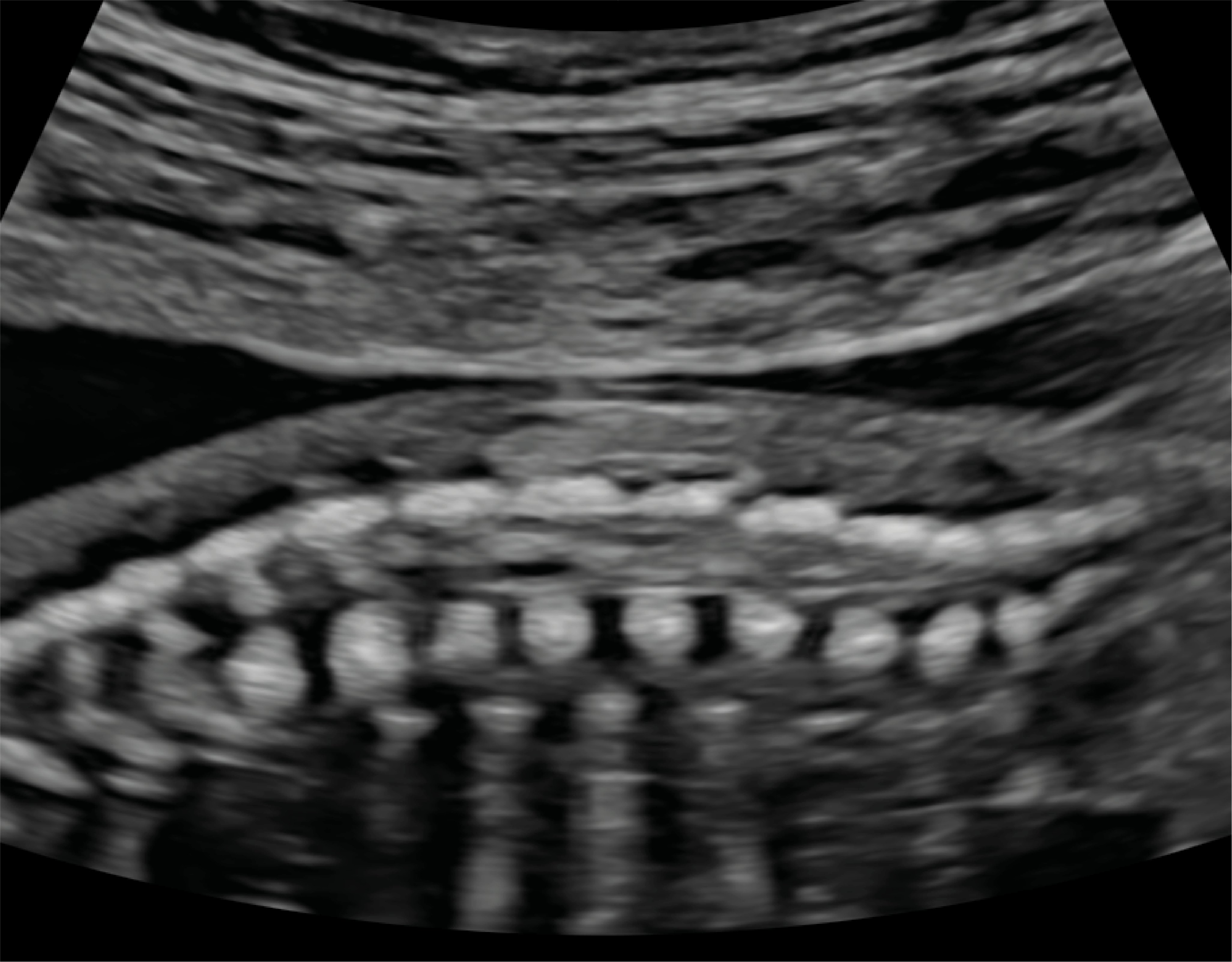 Recurso 3performance 16 18