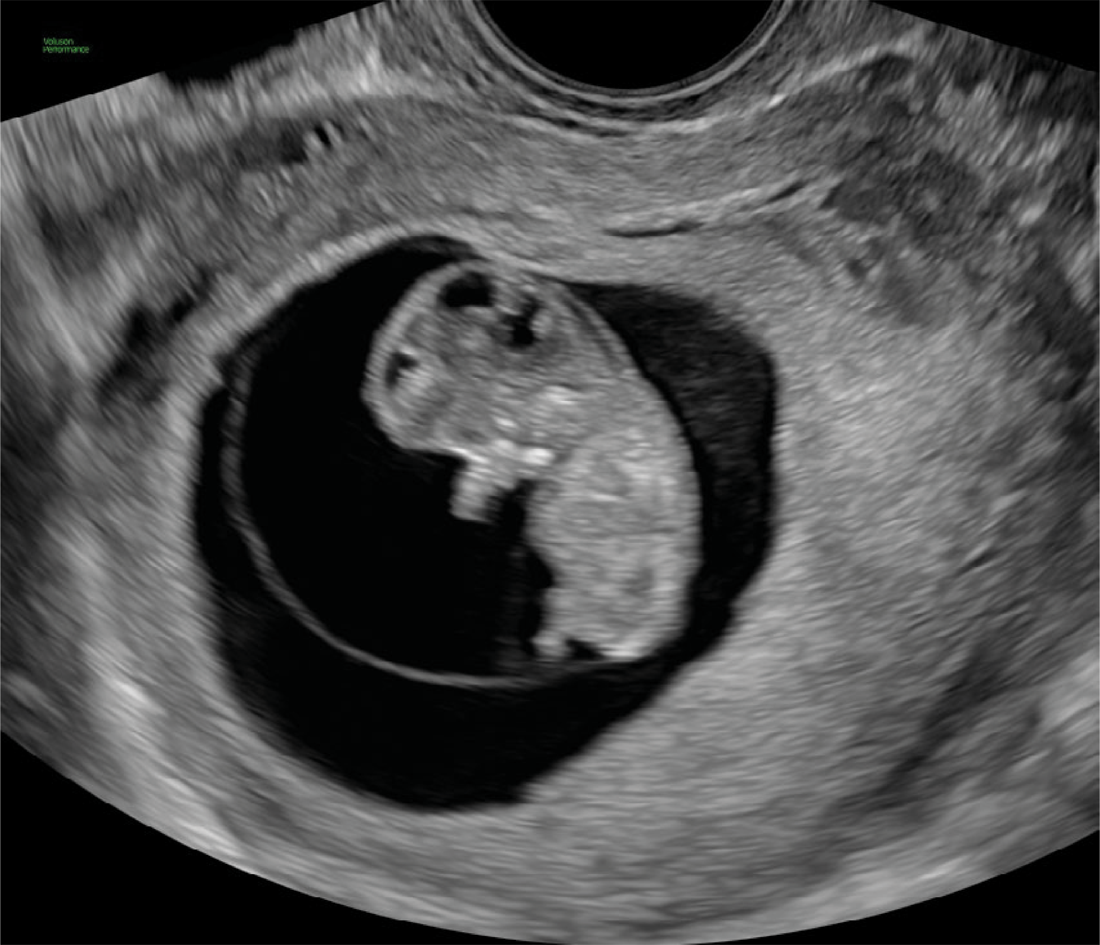 Recurso 4performance 16 18