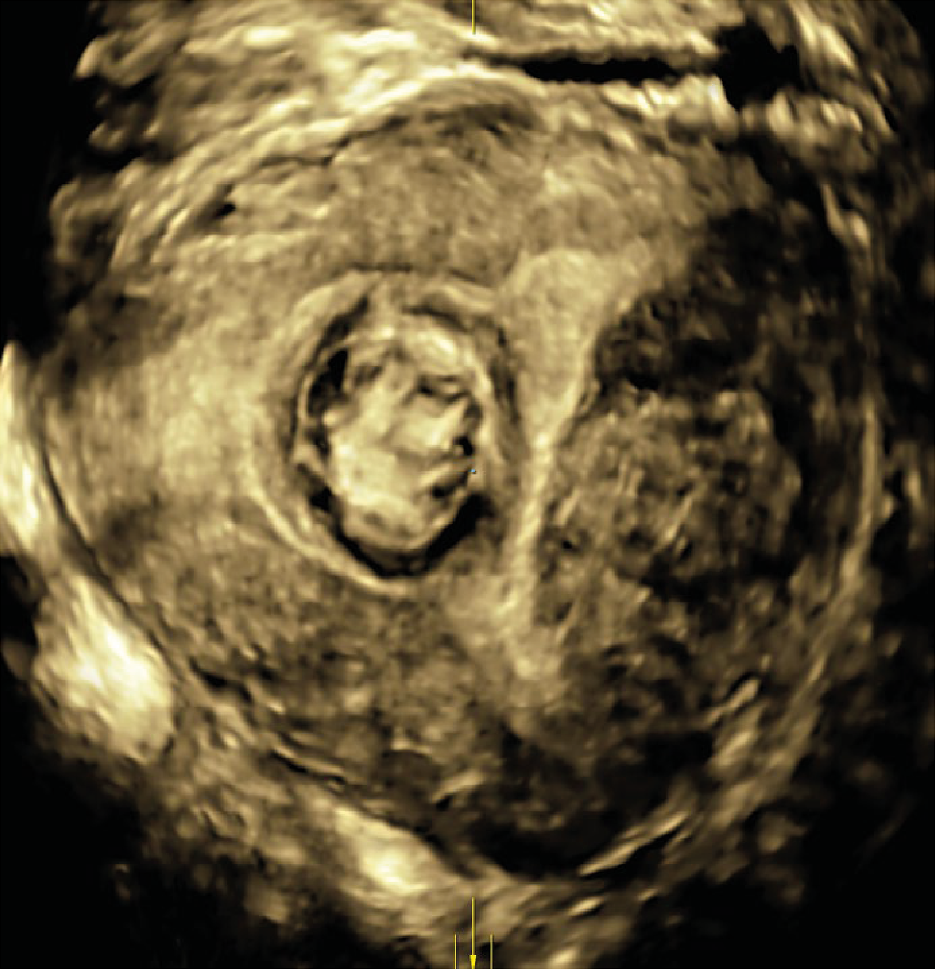 Recurso 5performance 16 18