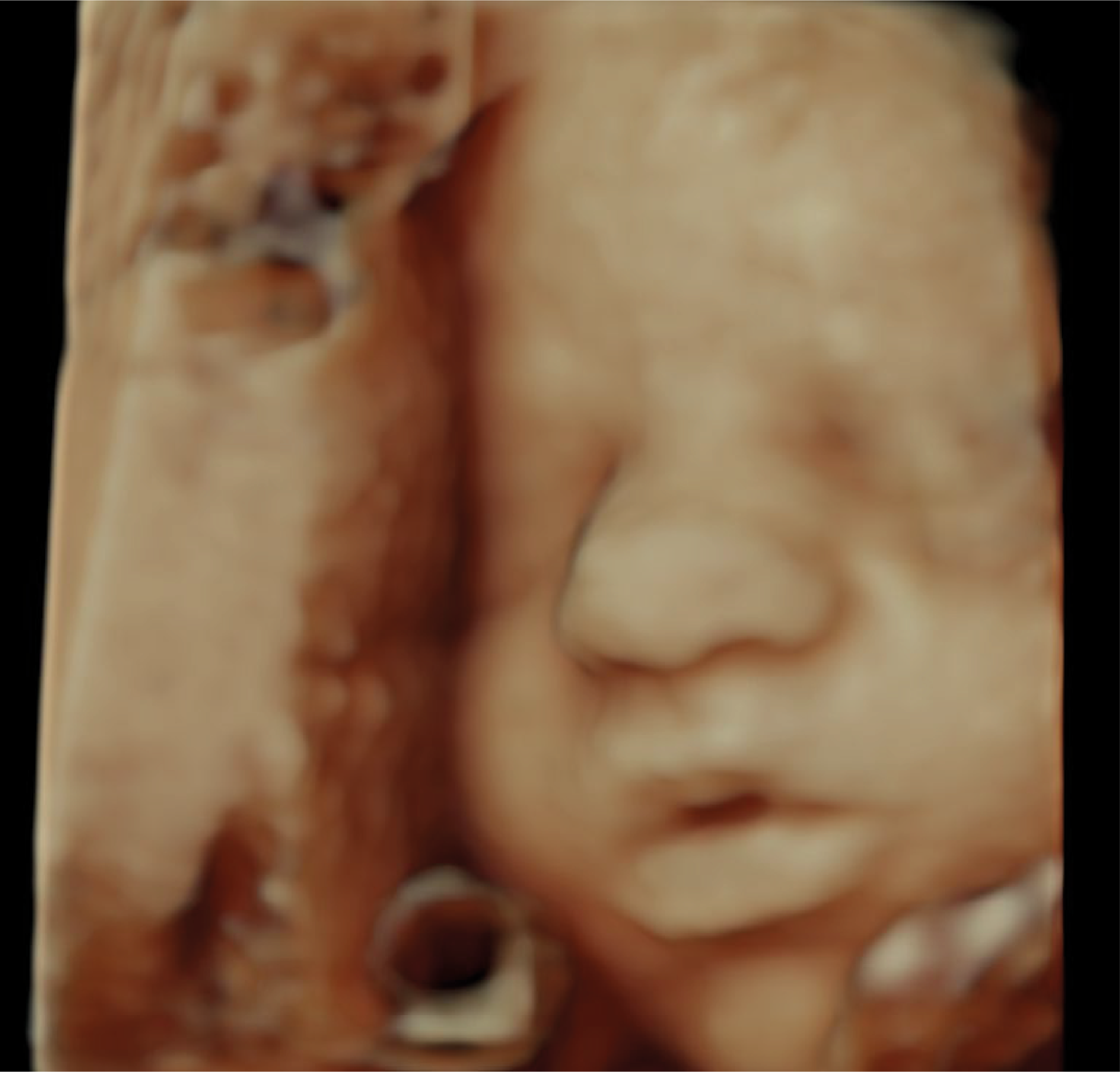 Recurso 6performance 16 18