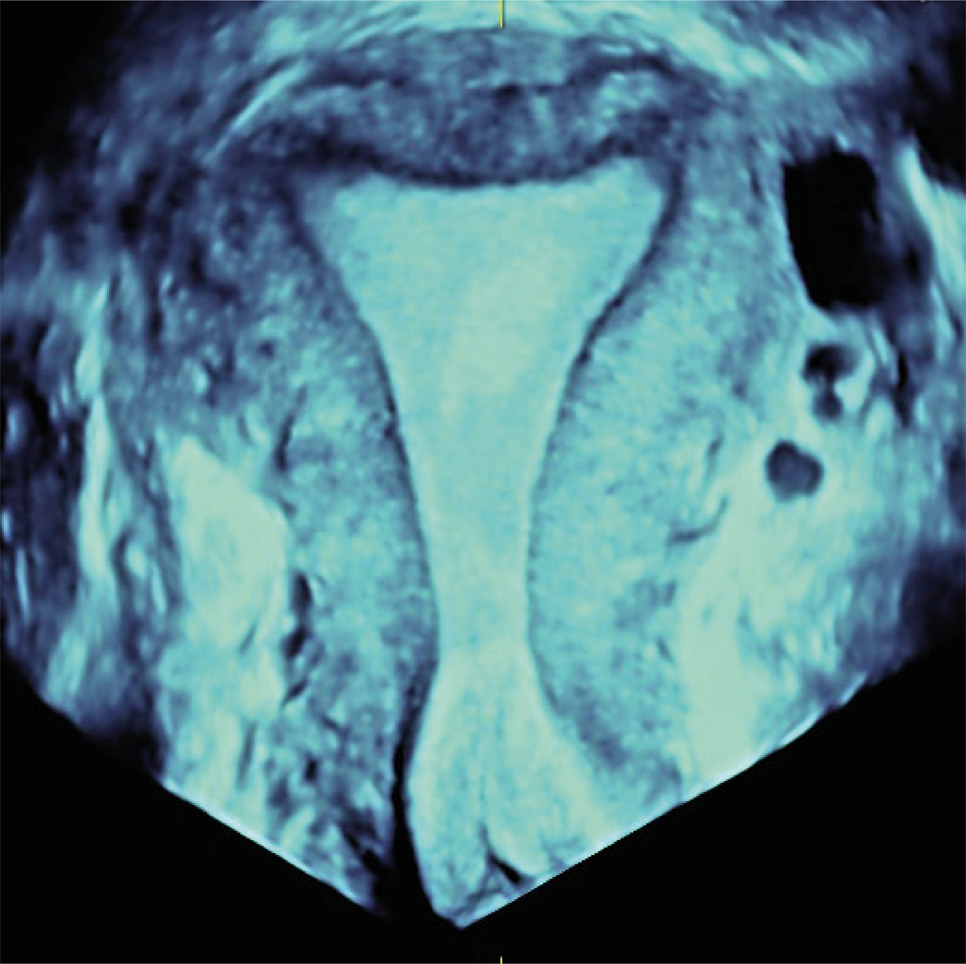 Recurso 7performance 16 18