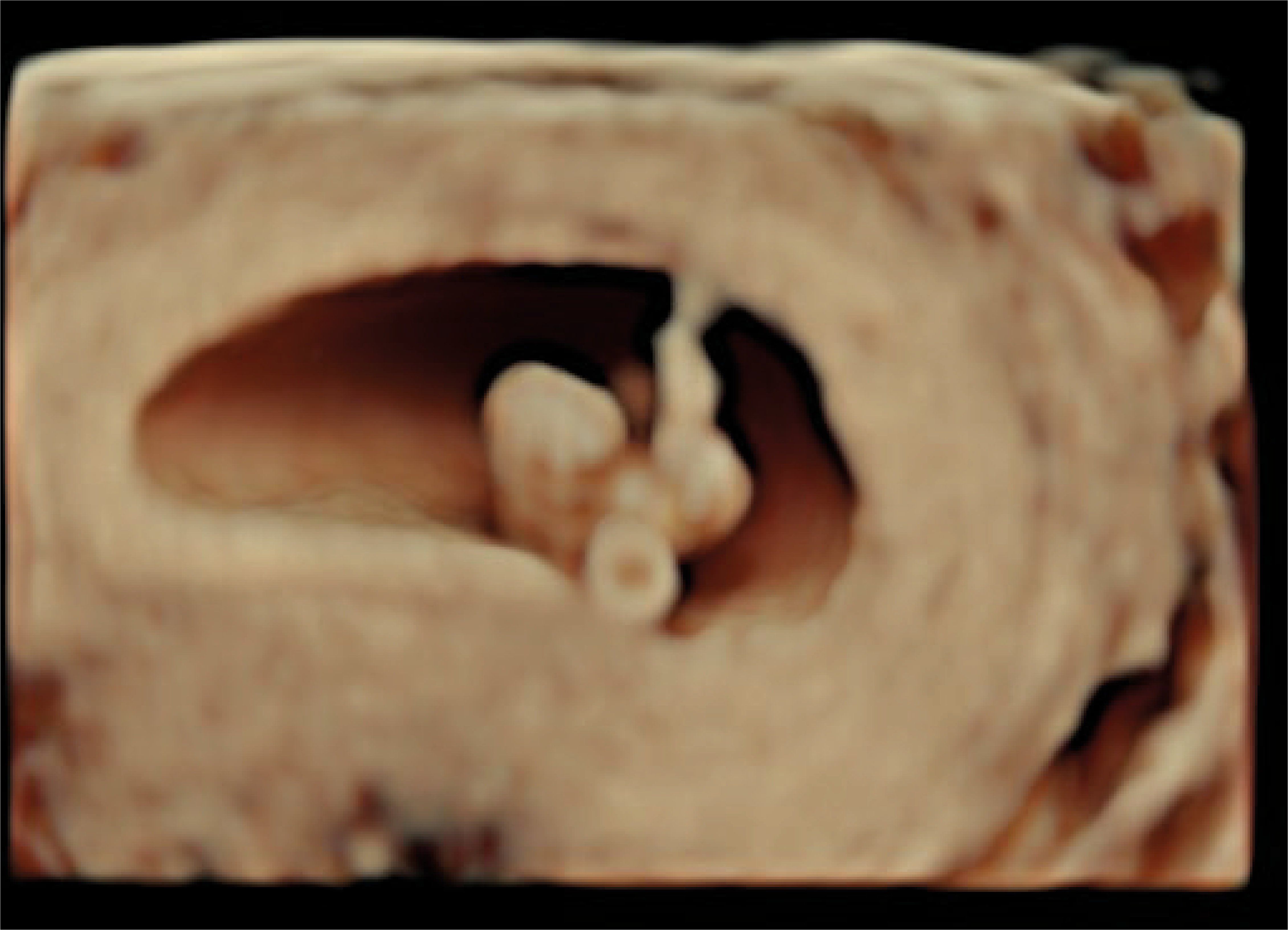 Recurso 8performance 16 18