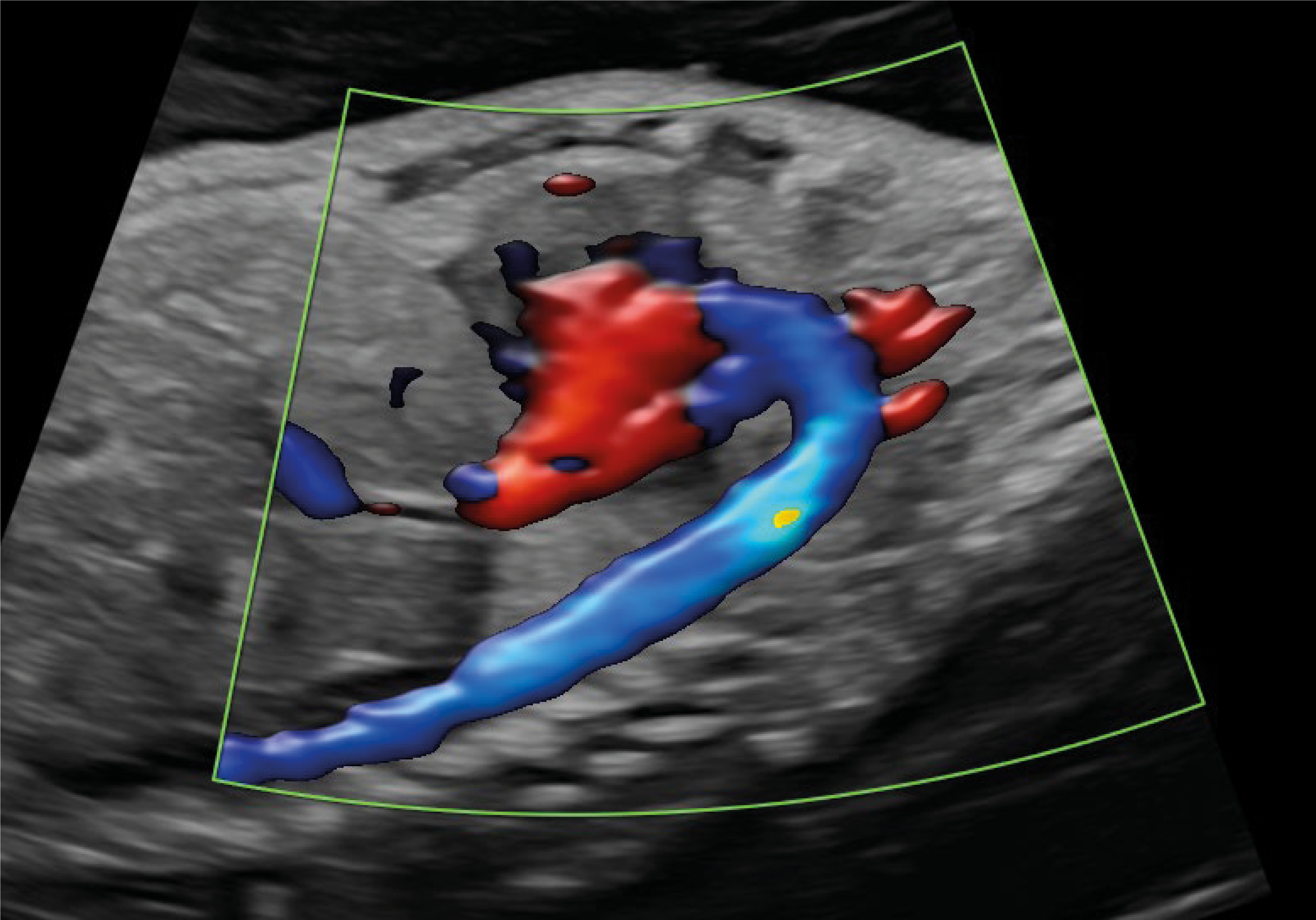 Recurso 9performance 16 18