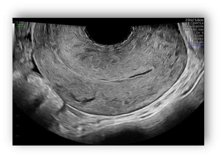 voluson expert gal 10