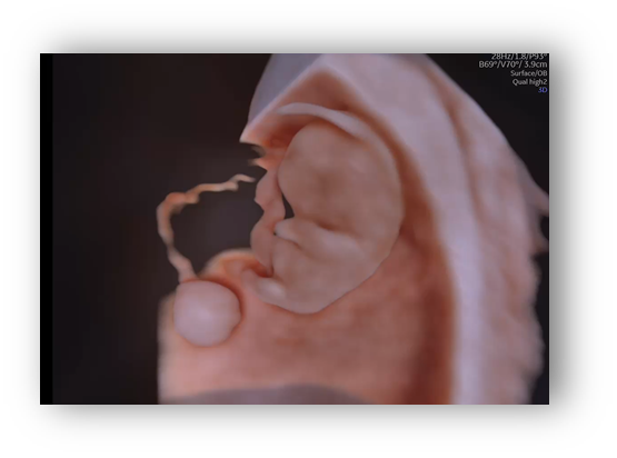 voluson expert gal 16