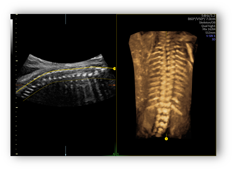voluson expert gal 20