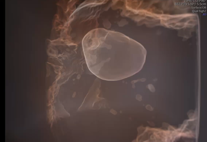 voluson expert gal 28