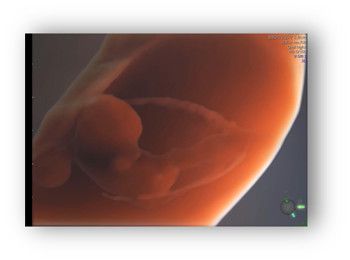 voluson expert gal 3