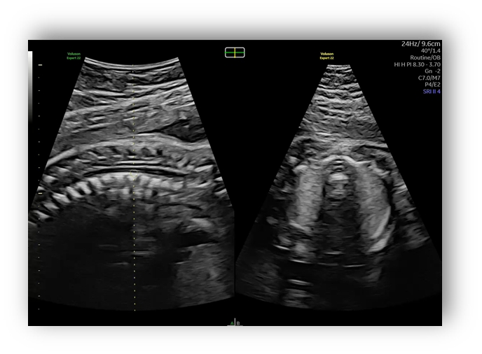 voluson expert gal 8