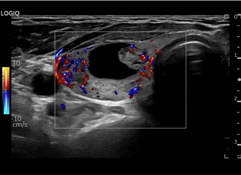 Logiq fortis Imagen1