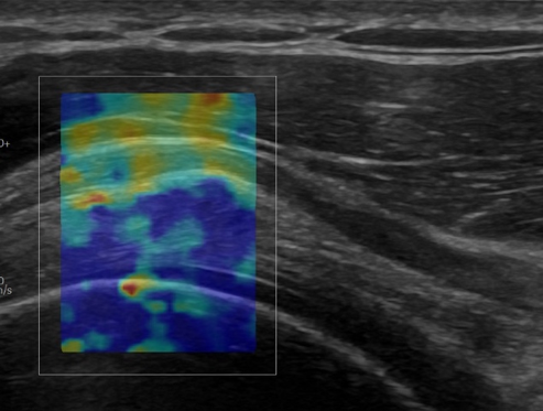 Logiq fortis Imagen10