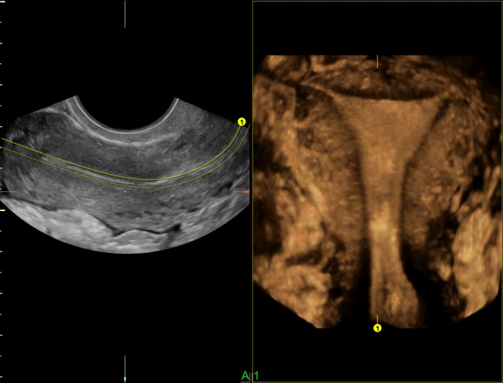 Logiq fortis Imagen11