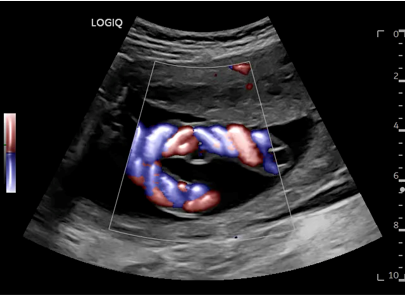 Logiq fortis Imagen4