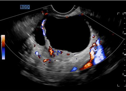 Logiq fortis Imagen5