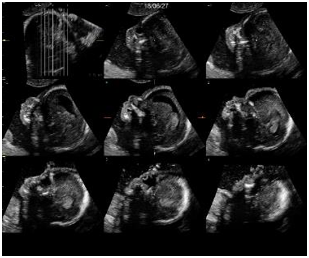 versana active Imagen2