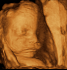 versana active Imagen3