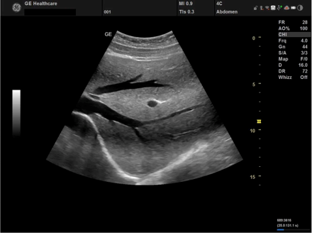 versana active Imagen4