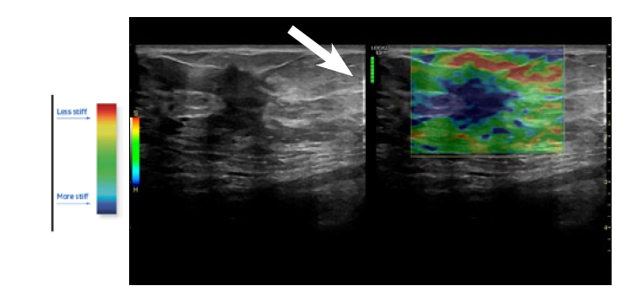 versana active Imagen5